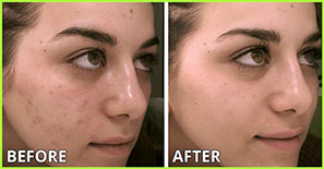 Before/After 1